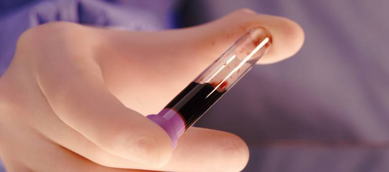 Test tube of blood